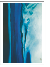 Bild: Erich Kraft, Kunstpostkarten. Titel:  Metamorphose II